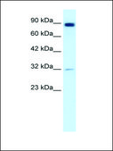 Anti-MMP9 antibody produced in rabbit IgG fraction of antiserum