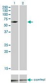 Monoclonal Anti-IRAK3, (C-terminal) antibody produced in mouse clone 1F6, purified immunoglobulin, buffered aqueous solution