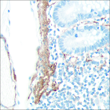 Anti-SMA antibody, Rabbit monoclonal recombinant, expressed in proprietary host, clone SP171, affinity isolated antibody