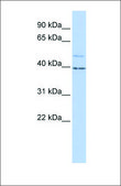 Anti-KCNK9 antibody produced in rabbit affinity isolated antibody