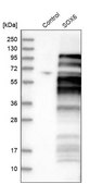 Anti-SOX6 antibody produced in rabbit Ab2, Prestige Antibodies&#174; Powered by Atlas Antibodies, affinity isolated antibody, buffered aqueous glycerol solution