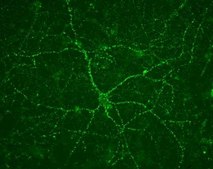 Anti-Vesicular Glutamate Transporter 1 Antibody clone 3C10.2, Chemicon&#174;, from mouse