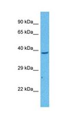 Anti-AKR1B1 antibody produced in rabbit affinity isolated antibody