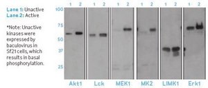 Anti-Phosphoserine Antibody, clone 4A4 (mouse IgG1) clone 4A4, Upstate&#174;, from mouse