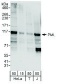 Rabbit anti-PML Antibody, Affinity Purified Powered by Bethyl Laboratories, Inc.