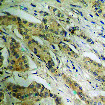 Anti-phospho-ATP-Citrate Lyase (pSer454) antibody produced in rabbit affinity isolated antibody