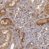 Anti-CFB antibody produced in rabbit Ab3, Prestige Antibodies&#174; Powered by Atlas Antibodies, affinity isolated antibody, buffered aqueous glycerol solution