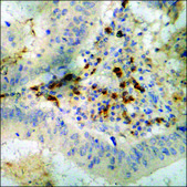 Anti-phospho-Lyn (pTyr507) antibody produced in rabbit affinity isolated antibody
