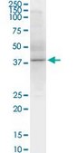 Monoclonal Anti-SPHK1 antibody produced in mouse clone 1D6, purified immunoglobulin, buffered aqueous solution
