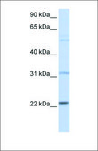Anti-CDC42 antibody produced in rabbit affinity isolated antibody