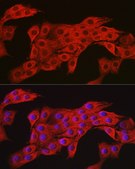 Anti- AMPK&#945;2 antibody produced in rabbit