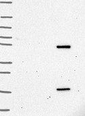 Anti-CARM1 antibody produced in rabbit Prestige Antibodies&#174; Powered by Atlas Antibodies, affinity isolated antibody, buffered aqueous glycerol solution