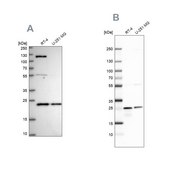 Anti-UQCRFS1 antibody produced in rabbit Prestige Antibodies&#174; Powered by Atlas Antibodies, affinity isolated antibody, buffered aqueous glycerol solution