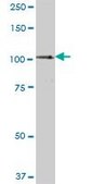 Anti-STAT6 antibody produced in mouse purified immunoglobulin, buffered aqueous solution