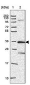 Anti-CAMK2A antibody produced in rabbit Prestige Antibodies® Powered by Atlas Antibodies, affinity isolated antibody, buffered aqueous glycerol solution
