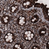 Monoclonal Anti-CS antibody produced in mouse Prestige Antibodies&#174; Powered by Atlas Antibodies, clone CL2548, purified immunoglobulin, buffered aqueous glycerol solution