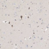 Anti-NELL2 antibody produced in rabbit Prestige Antibodies&#174; Powered by Atlas Antibodies, affinity isolated antibody, buffered aqueous glycerol solution