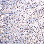 Anti-GLUD1 antibody produced in rabbit