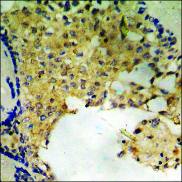 Anti-phospho-Smad2 (pSer250) antibody produced in rabbit affinity isolated antibody