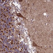 Anti-CS antibody produced in rabbit Prestige Antibodies&#174; Powered by Atlas Antibodies, affinity isolated antibody, buffered aqueous glycerol solution