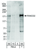 Rabbit anti-FANCD2 Antibody, Affinity Purified Powered by Bethyl Laboratories, Inc.
