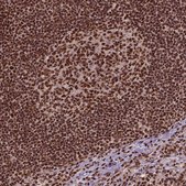 Anti-SIRT6 antibody produced in rabbit Prestige Antibodies&#174; Powered by Atlas Antibodies, affinity isolated antibody, buffered aqueous glycerol solution