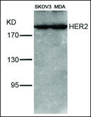 Anti-ERBB2 (Ab-1221/1222) antibody produced in rabbit affinity isolated antibody