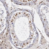 ANTI-SUN2 antibody produced in rabbit Prestige Antibodies&#174; Powered by Atlas Antibodies, affinity isolated antibody, buffered aqueous glycerol solution