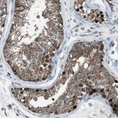 Anti-ARID5B antibody produced in rabbit Prestige Antibodies&#174; Powered by Atlas Antibodies, affinity isolated antibody, buffered aqueous glycerol solution