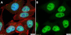 Anti-RPA1 Antibody, clone 1J5 ZooMAb&#174; Rabbit Monoclonal recombinant, expressed in HEK 293 cells