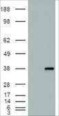 Anti-Monoglyceride lipase antibody produced in goat affinity isolated antibody, buffered aqueous solution
