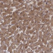 Anti-SULT2A1 antibody produced in rabbit Prestige Antibodies&#174; Powered by Atlas Antibodies, affinity isolated antibody, buffered aqueous glycerol solution