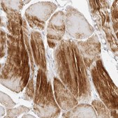 Anti-MAP2K5 antibody produced in rabbit Prestige Antibodies&#174; Powered by Atlas Antibodies, affinity isolated antibody, buffered aqueous glycerol solution, ab1