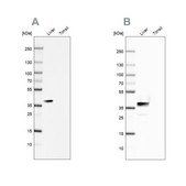 Anti-ARG1 antibody produced in rabbit Prestige Antibodies&#174; Powered by Atlas Antibodies, affinity isolated antibody, buffered aqueous glycerol solution