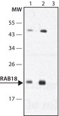 Anti-Rab18 antibody produced in rabbit ~1.0&#160;mg/mL, affinity isolated antibody
