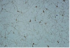 Anti-Opioid Receptor Antibody, &#948;, pain, NT serum, Chemicon&#174;