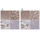 Anti-PDHB antibody produced in rabbit Prestige Antibodies&#174; Powered by Atlas Antibodies, affinity isolated antibody, buffered aqueous glycerol solution
