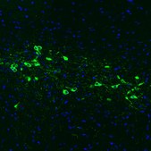 Monoclonal Anti-TH antibody produced in mouse Prestige Antibodies&#174; Powered by Atlas Antibodies, clone CL3049, purified immunoglobulin, buffered aqueous glycerol solution