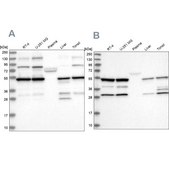 Anti-PDHX antibody produced in rabbit Prestige Antibodies&#174; Powered by Atlas Antibodies, affinity isolated antibody, buffered aqueous glycerol solution