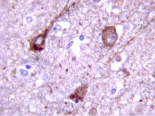 Anti-Tau phospho Threonine 231 Antibody Chemicon&#174;, from rabbit