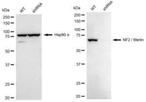 KD-Validated Anti NF2 / Merlin Antibody, clone 23GB2620, Rabbit Monoclonal clone 23GB2620, recombinant rabbit monoclonal, expressed in HEK293 cells