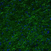 Monoclonal Anti-TPH2 antibody produced in mouse Prestige Antibodies&#174; Powered by Atlas Antibodies, clone CL2990, purified immunoglobulin, buffered aqueous glycerol solution