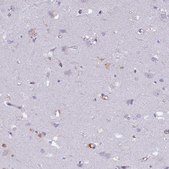 Anti-FYB antibody produced in rabbit Prestige Antibodies&#174; Powered by Atlas Antibodies, affinity isolated antibody, buffered aqueous glycerol solution