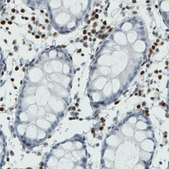 Monoclonal Anti-RUNX2 antibody produced in mouse Prestige Antibodies&#174; Powered by Atlas Antibodies, clone CL0232, purified immunoglobulin, buffered aqueous glycerol solution