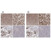 Anti-PDHB antibody produced in rabbit Prestige Antibodies&#174; Powered by Atlas Antibodies, affinity isolated antibody, buffered aqueous glycerol solution