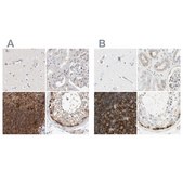 Anti-NFKB2 antibody produced in rabbit Prestige Antibodies&#174; Powered by Atlas Antibodies, affinity isolated antibody, buffered aqueous glycerol solution