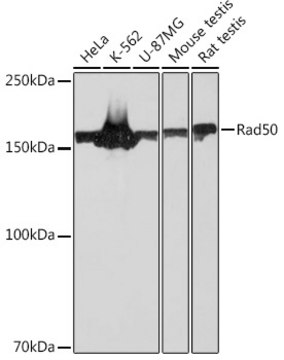 Anti-Rad50 Antibody, clone 5M2K10, Rabbit Monoclonal