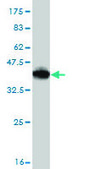 Monoclonal Anti-CD40LG antibody produced in mouse clone 2E2, purified immunoglobulin, buffered aqueous solution
