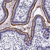 Anti-ACE2 antibody produced in rabbit Prestige Antibodies&#174; Powered by Atlas Antibodies, affinity isolated antibody, buffered aqueous glycerol solution