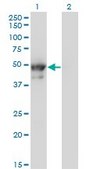 Monoclonal Anti-KRT8 antibody produced in mouse clone 3E3, purified immunoglobulin, buffered aqueous solution